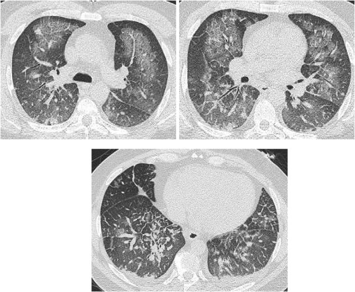 https://cdn.ncbi.nlm.nih.gov/pmc/blobs/499b/7607415/98014d35628d/gr8.jpg