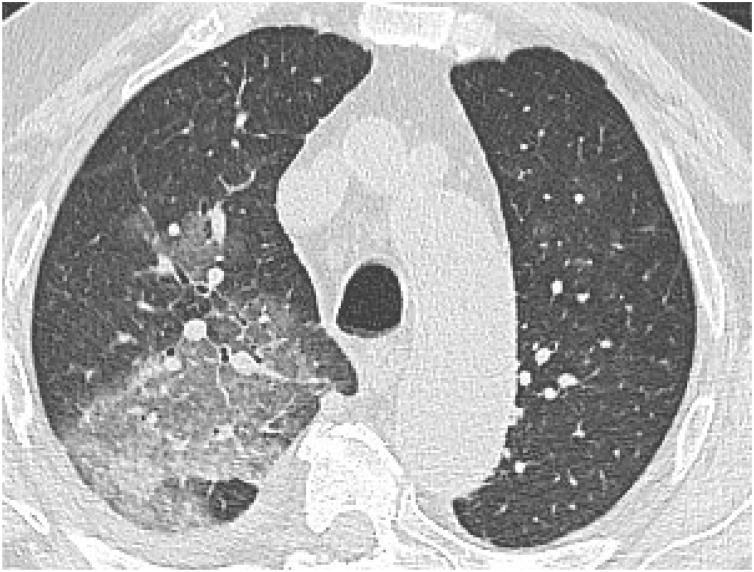 https://cdn.ncbi.nlm.nih.gov/pmc/blobs/499b/7607415/e7f7b00a35f5/gr12.jpg