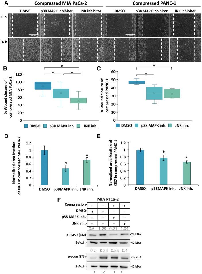 https://cdn.ncbi.nlm.nih.gov/pmc/blobs/49a1/9381108/f12e0c48d05b/485fig3.jpg