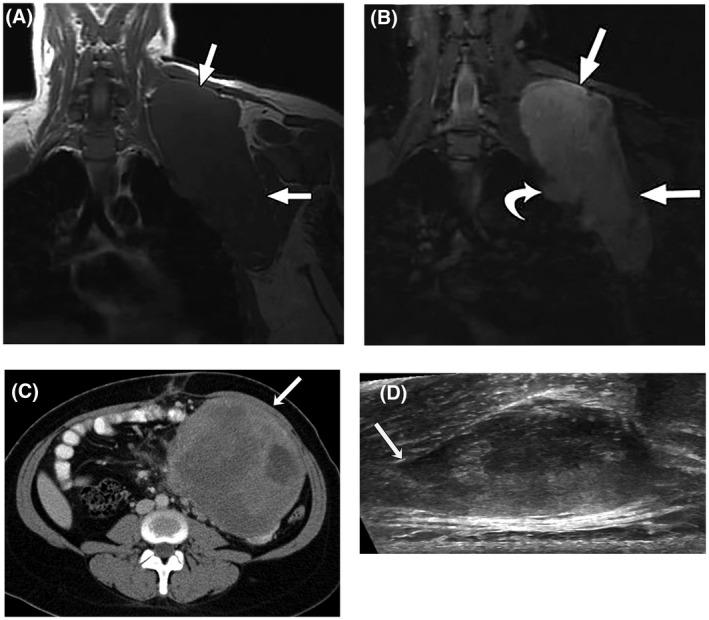 https://cdn.ncbi.nlm.nih.gov/pmc/blobs/49a4/9546183/1010647702cd/CNCR-128-3027-g003.jpg