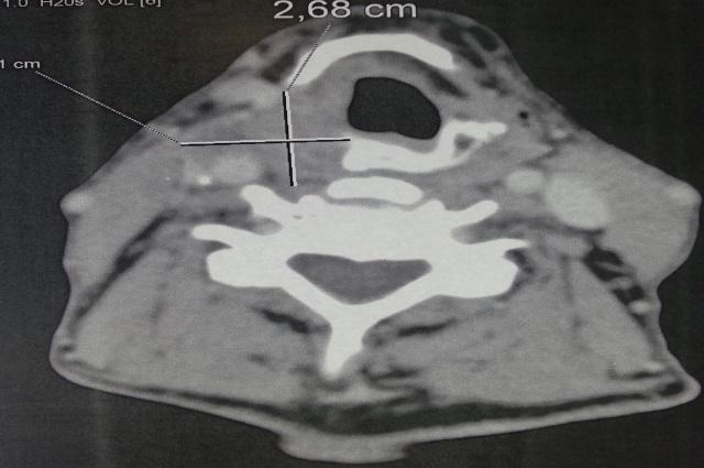 https://cdn.ncbi.nlm.nih.gov/pmc/blobs/49aa/5483368/44e7c695600d/PAMJ-26-189-g002.jpg