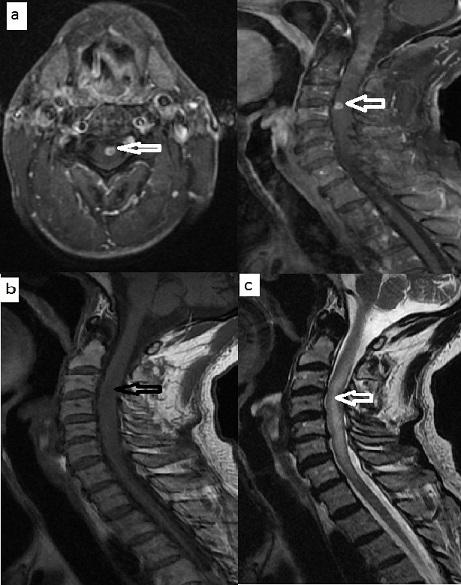 https://cdn.ncbi.nlm.nih.gov/pmc/blobs/49aa/5483368/adb37eb360d5/PAMJ-26-189-g003.jpg