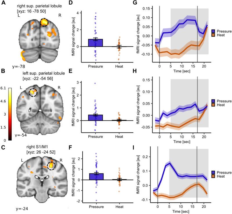 https://cdn.ncbi.nlm.nih.gov/pmc/blobs/49ad/12022288/bcb2e47f1774/41598_2025_99247_Fig4_HTML.jpg