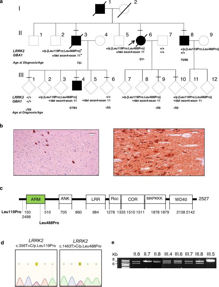 https://cdn.ncbi.nlm.nih.gov/pmc/blobs/49ae/12145433/cc23923d86de/41531_2025_989_Fig1_HTML.jpg