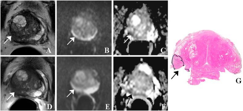 https://cdn.ncbi.nlm.nih.gov/pmc/blobs/49ae/5286427/f63c91323aa1/srep40640-f2.jpg