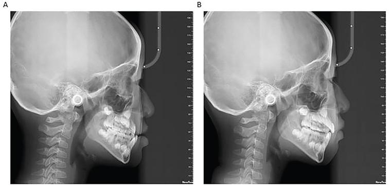 https://cdn.ncbi.nlm.nih.gov/pmc/blobs/49b0/12398110/ff9624bc7fb7/AOS-84-44580-g003.jpg