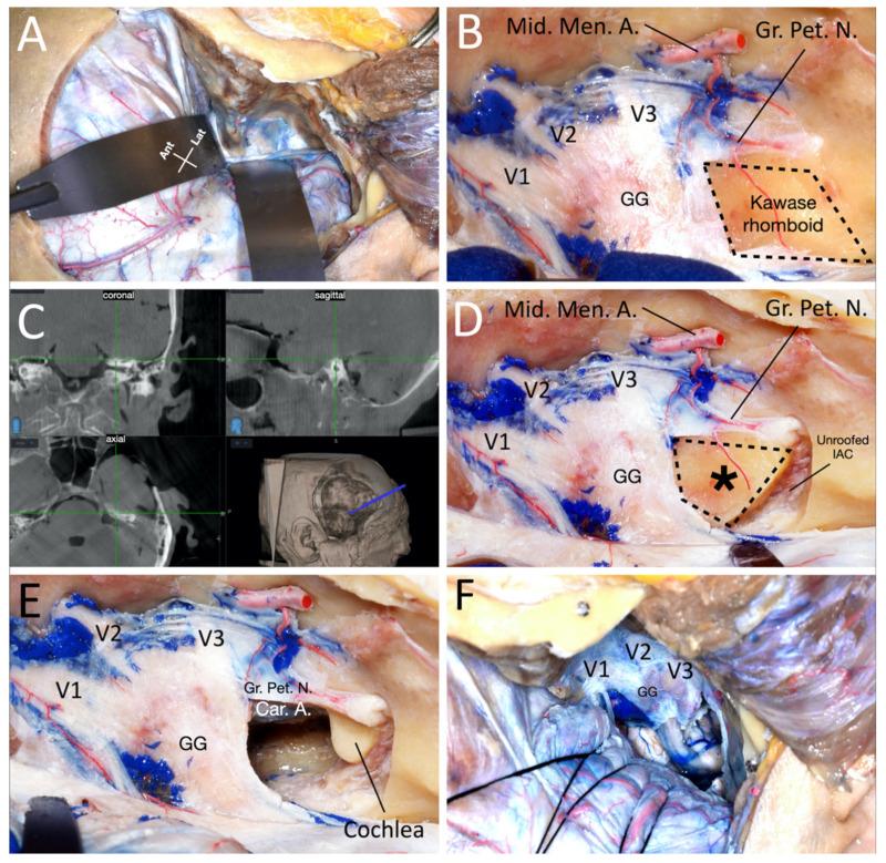 https://cdn.ncbi.nlm.nih.gov/pmc/blobs/49b2/8069204/a82f03a23ac1/brainsci-11-00488-g003.jpg