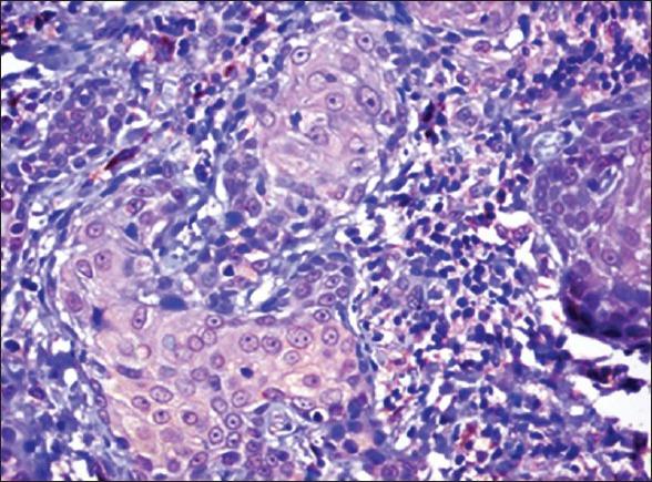 https://cdn.ncbi.nlm.nih.gov/pmc/blobs/49b3/3830224/5e57f648aaa8/JOMFP-17-185-g008.jpg