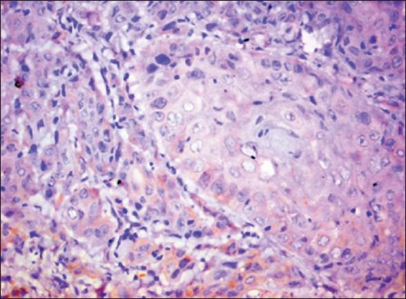 https://cdn.ncbi.nlm.nih.gov/pmc/blobs/49b3/3830224/c336933a7170/JOMFP-17-185-g007.jpg