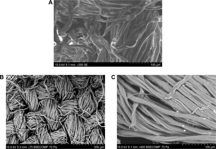 https://cdn.ncbi.nlm.nih.gov/pmc/blobs/49b3/4599608/cda594f22b29/ijn-10-087Fig9.jpg