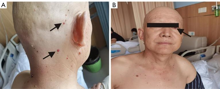 https://cdn.ncbi.nlm.nih.gov/pmc/blobs/49be/9459630/2fc2e9017449/tcr-11-08-2940-f2.jpg