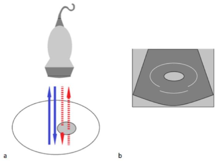 https://cdn.ncbi.nlm.nih.gov/pmc/blobs/49c6/8947314/0d65b71eff4f/diagnostics-12-00631-g006.jpg