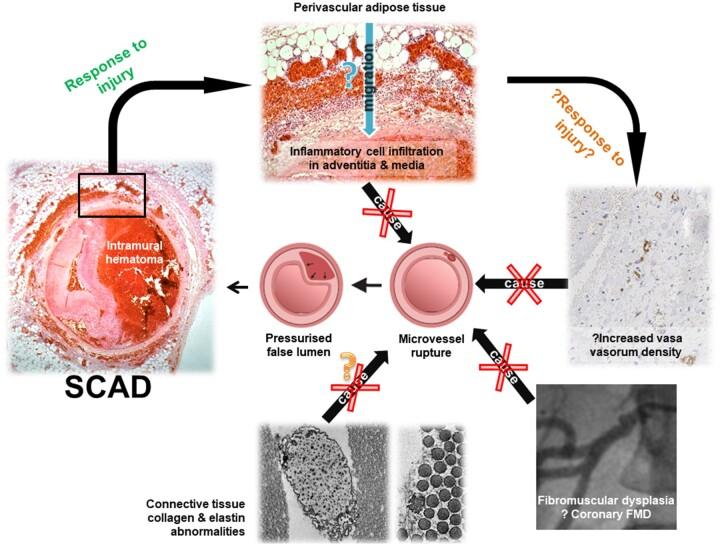 https://cdn.ncbi.nlm.nih.gov/pmc/blobs/49c9/9215198/acfeb8abf65d/cvab183ga1.jpg