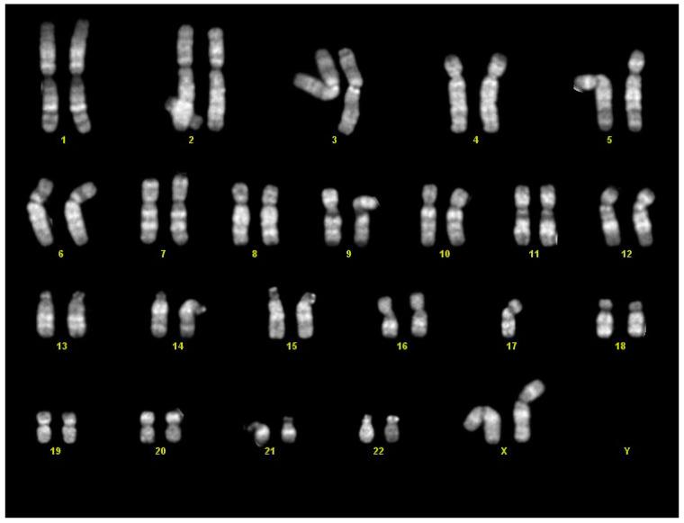 https://cdn.ncbi.nlm.nih.gov/pmc/blobs/49cc/8468681/1b85dcdbebe3/diagnostics-11-01543-g006.jpg