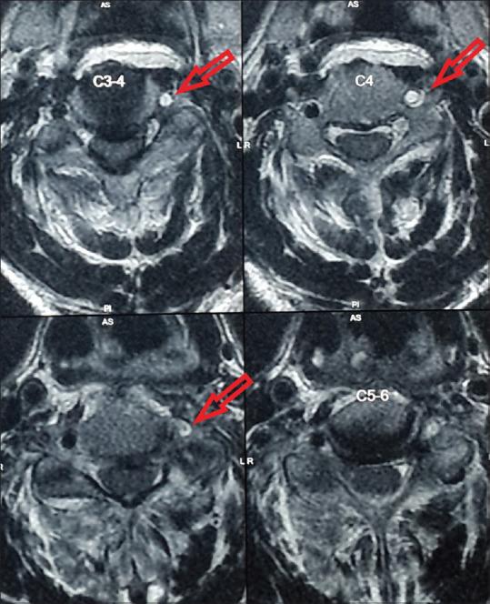 https://cdn.ncbi.nlm.nih.gov/pmc/blobs/49d9/7591224/6822d6f2608d/AJNS-15-644-g001.jpg