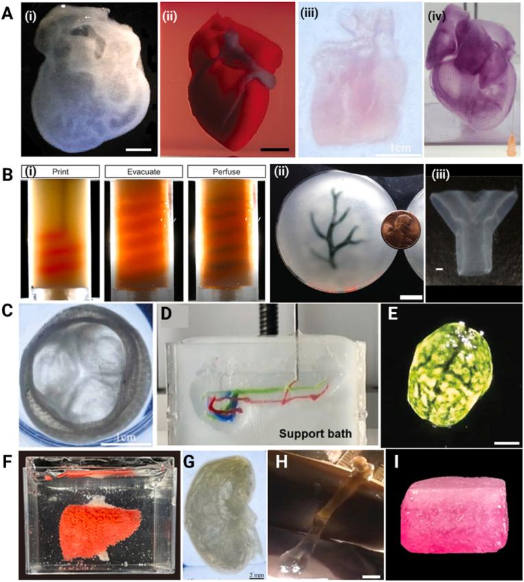 https://cdn.ncbi.nlm.nih.gov/pmc/blobs/49da/12281243/10eb4057c25d/gr3.jpg