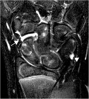 https://cdn.ncbi.nlm.nih.gov/pmc/blobs/49de/4444796/0f3c96fe758f/13244_2015_406_Fig10_HTML.jpg