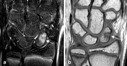 https://cdn.ncbi.nlm.nih.gov/pmc/blobs/49de/4444796/1b92ccc63ae9/13244_2015_406_Fig12_HTML.jpg