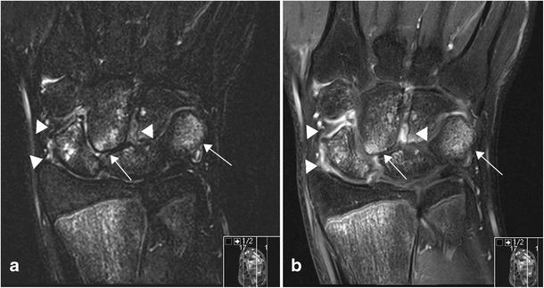 https://cdn.ncbi.nlm.nih.gov/pmc/blobs/49de/4444796/1f353e3455a6/13244_2015_406_Fig8_HTML.jpg