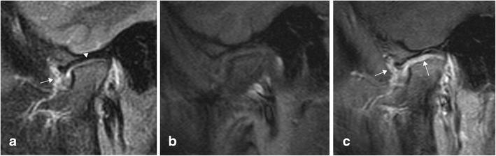https://cdn.ncbi.nlm.nih.gov/pmc/blobs/49de/4444796/9ab81dce5978/13244_2015_406_Fig6_HTML.jpg