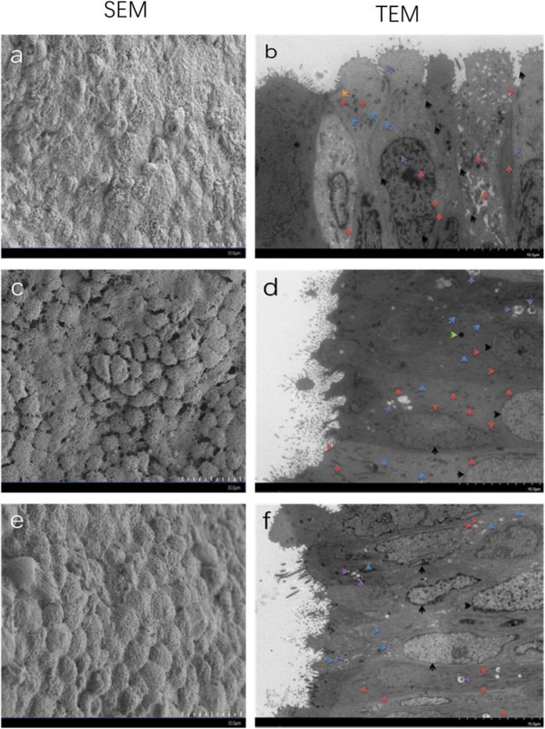 https://cdn.ncbi.nlm.nih.gov/pmc/blobs/49e0/7079352/235761391a1b/12958_2020_579_Fig1_HTML.jpg