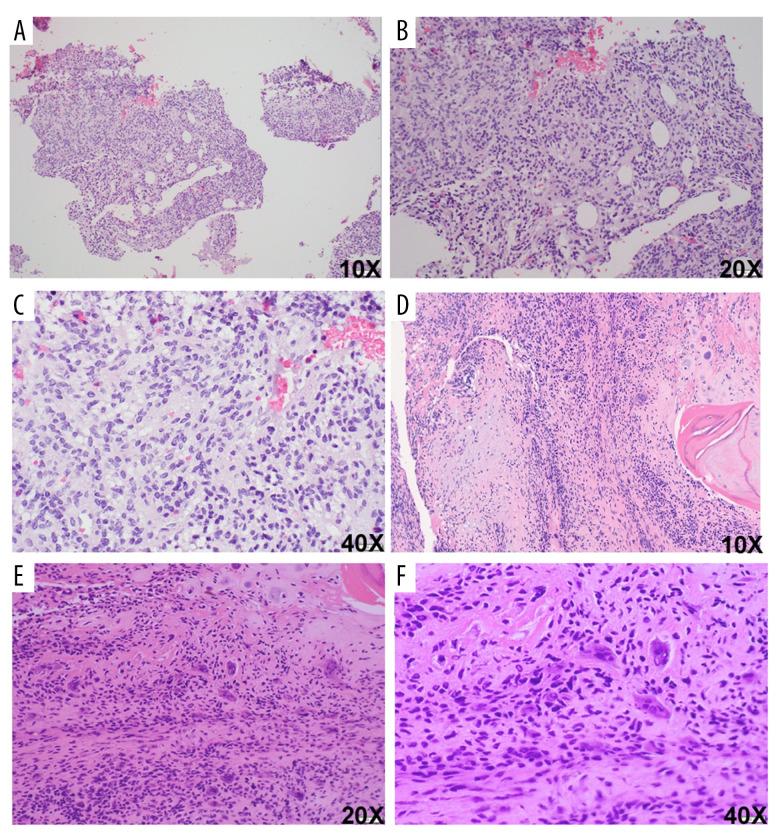 https://cdn.ncbi.nlm.nih.gov/pmc/blobs/49e1/10877641/ca40913a82ed/amjcaserep-25-e942810-g002.jpg