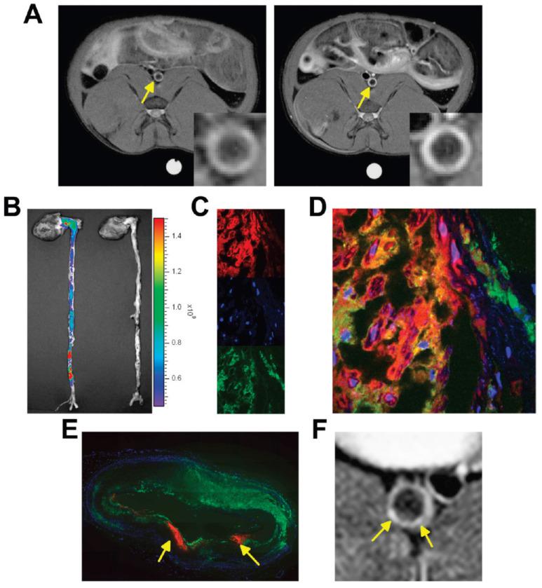 https://cdn.ncbi.nlm.nih.gov/pmc/blobs/49eb/11093717/1e8291d7c199/ntnov08p0401g003.jpg
