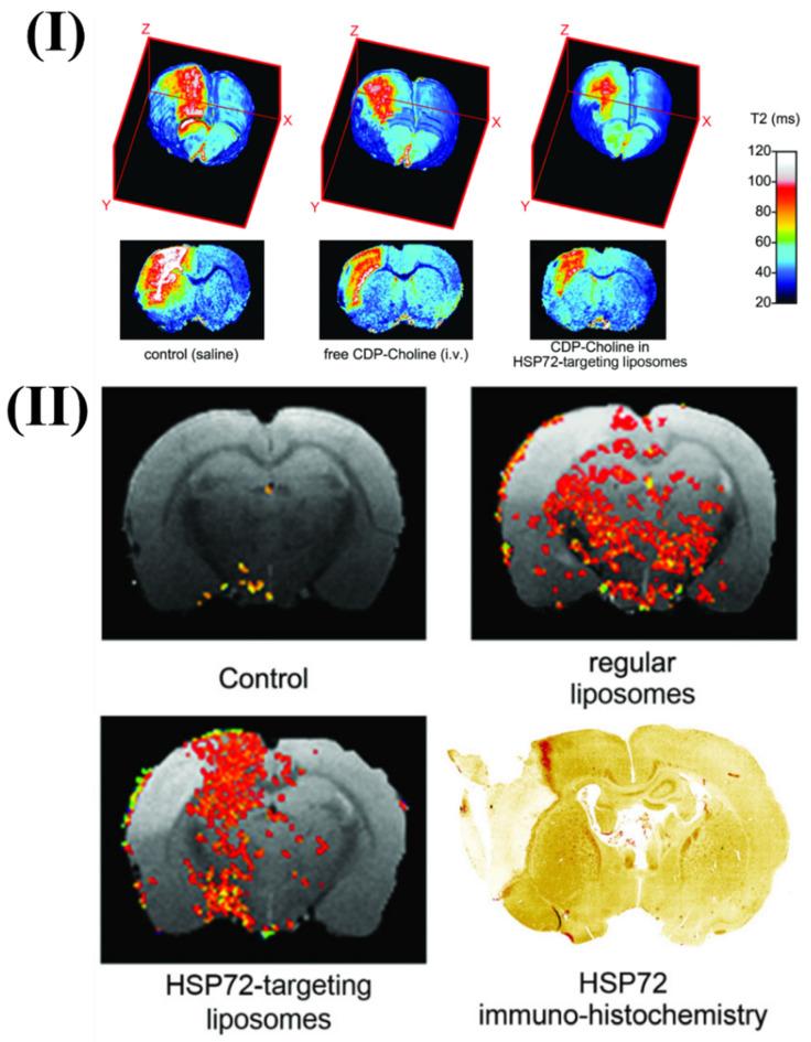 https://cdn.ncbi.nlm.nih.gov/pmc/blobs/49eb/11093717/22fb7d66b14d/ntnov08p0401g002.jpg