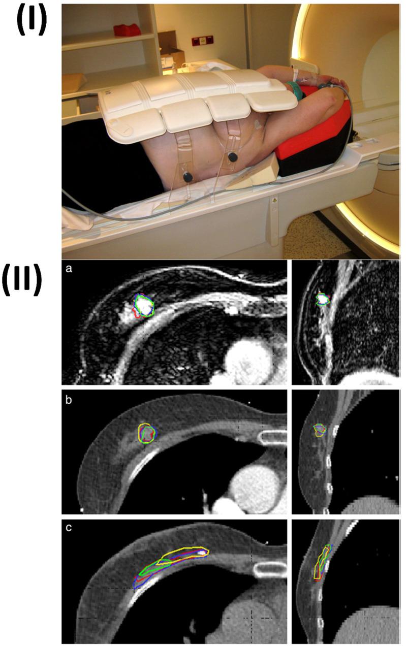 https://cdn.ncbi.nlm.nih.gov/pmc/blobs/49eb/11093717/f77c5b250fb0/ntnov08p0401g007.jpg