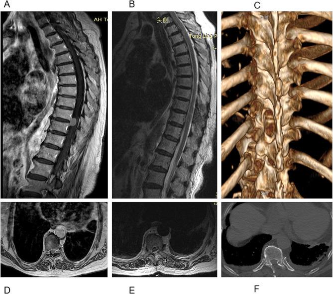 https://cdn.ncbi.nlm.nih.gov/pmc/blobs/49f3/11245853/2c160a110f4d/13019_2024_2969_Fig4_HTML.jpg