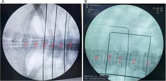 https://cdn.ncbi.nlm.nih.gov/pmc/blobs/49f3/11245853/fa2534eefbfd/13019_2024_2969_Fig1_HTML.jpg