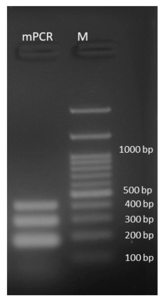 https://cdn.ncbi.nlm.nih.gov/pmc/blobs/49f3/9689860/e2f95dd4f45d/diagnostics-12-02691-g003.jpg