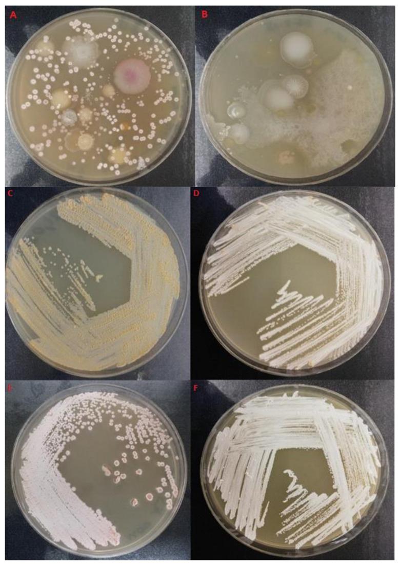 https://cdn.ncbi.nlm.nih.gov/pmc/blobs/49f4/8151412/ceaae2e54365/pathogens-10-00579-g001.jpg