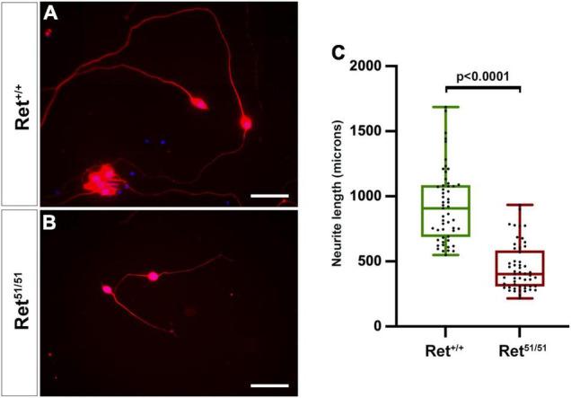 https://cdn.ncbi.nlm.nih.gov/pmc/blobs/49f4/9186293/d97f48a26ef9/fnmol-15-832317-g004.jpg