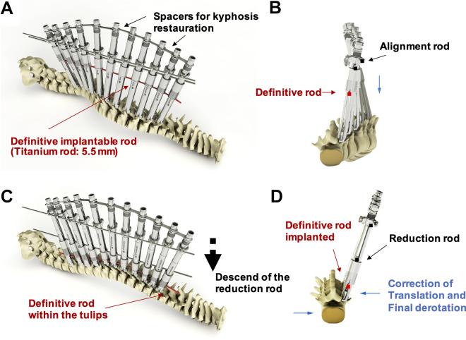 https://cdn.ncbi.nlm.nih.gov/pmc/blobs/49f4/9837503/565f5be6ce2a/10.1177_2192568221992313-fig3.jpg