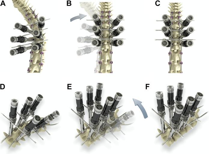 https://cdn.ncbi.nlm.nih.gov/pmc/blobs/49f4/9837503/9dce471c4442/10.1177_2192568221992313-fig1.jpg