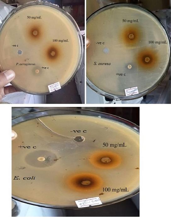 https://cdn.ncbi.nlm.nih.gov/pmc/blobs/49fb/12010763/2f70a8932c13/VMS3-11-e70231-g001.jpg