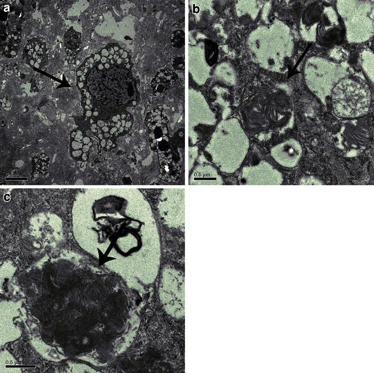 https://cdn.ncbi.nlm.nih.gov/pmc/blobs/4a03/3825558/268e981b3f94/246_2013_653_Fig2_HTML.jpg