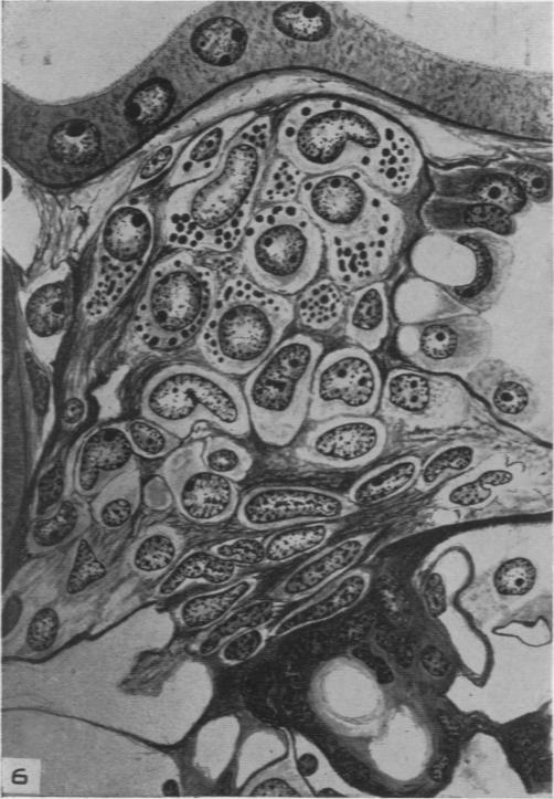 https://cdn.ncbi.nlm.nih.gov/pmc/blobs/4a06/1934300/78338a5d5309/amjpathol00501-0023-b.jpg