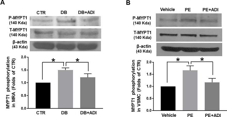 https://cdn.ncbi.nlm.nih.gov/pmc/blobs/4a0d/7077821/5114c2ed639b/pone.0230227.g005.jpg