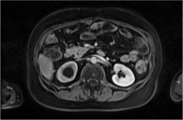 https://cdn.ncbi.nlm.nih.gov/pmc/blobs/4a11/3499435/8e9caa714f64/1477-7819-10-181-2.jpg