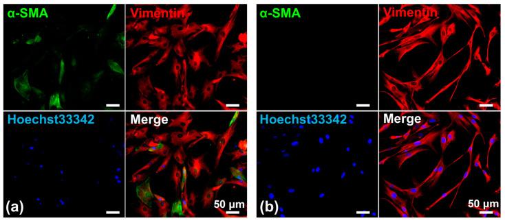 https://cdn.ncbi.nlm.nih.gov/pmc/blobs/4a14/11505046/ab98b778d9d1/biomedicines-12-02373-g004.jpg