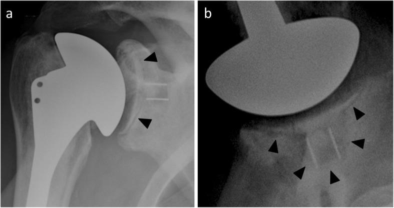 https://cdn.ncbi.nlm.nih.gov/pmc/blobs/4a14/6779685/460b0386ad78/13244_2019_788_Fig16_HTML.jpg