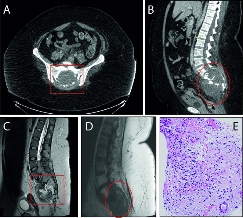 https://cdn.ncbi.nlm.nih.gov/pmc/blobs/4a1e/10603451/80dbf8c6ded0/bcr-2023-256611f01.jpg