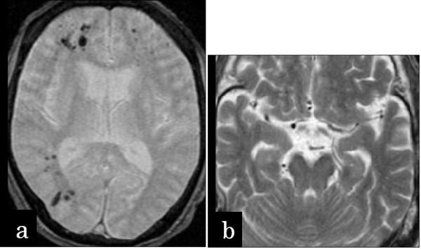 https://cdn.ncbi.nlm.nih.gov/pmc/blobs/4a20/3258223/de3af6a80cd5/1471-230X-11-139-1.jpg
