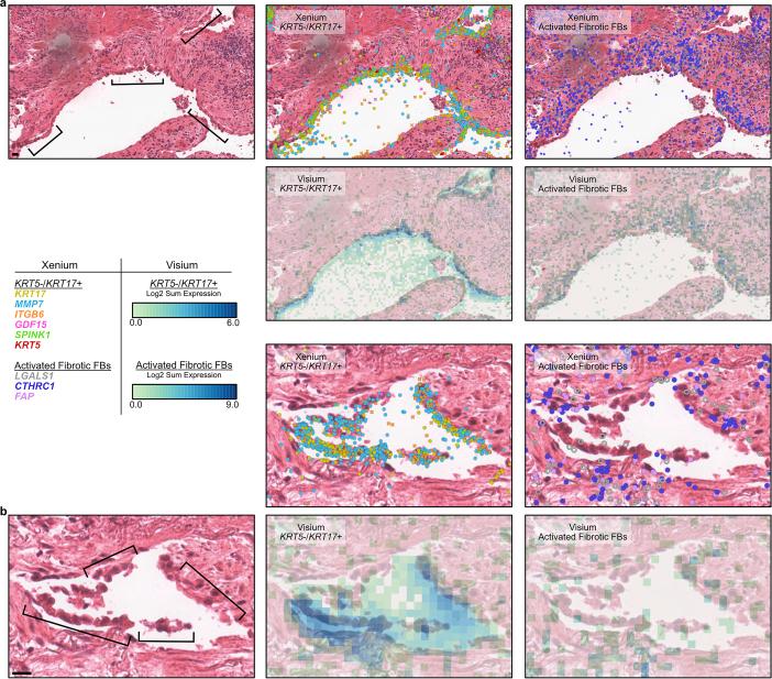 https://cdn.ncbi.nlm.nih.gov/pmc/blobs/4a21/11906353/0b7c29fffebd/41588_2025_2080_Fig16_ESM.jpg
