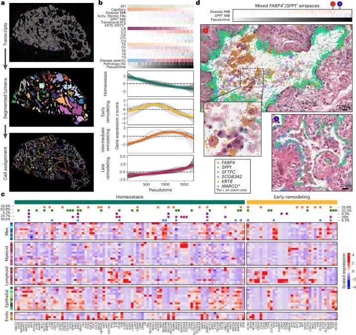 https://cdn.ncbi.nlm.nih.gov/pmc/blobs/4a21/11906353/d531ab3bb96d/41588_2025_2080_Fig6_HTML.jpg