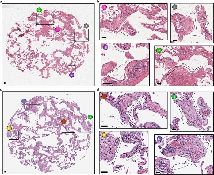 https://cdn.ncbi.nlm.nih.gov/pmc/blobs/4a21/11906353/f0cf18b168f4/41588_2025_2080_Fig14_ESM.jpg