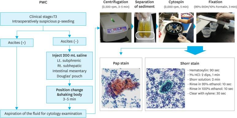 https://cdn.ncbi.nlm.nih.gov/pmc/blobs/4a26/6589424/0d747309435b/jgc-19-173-g001.jpg