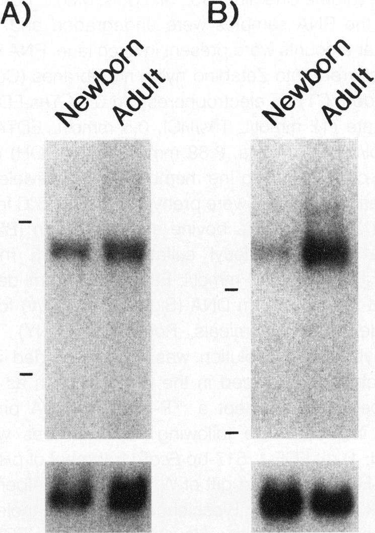 https://cdn.ncbi.nlm.nih.gov/pmc/blobs/4a2c/1865367/c155f491b0e9/amjpathol00036-0328-a.jpg
